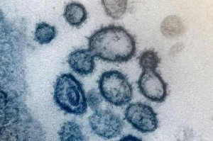 新冠疫情中的病毒，SARS-CoV-2