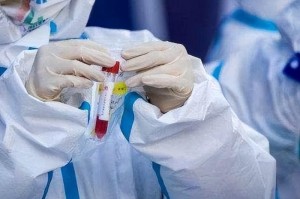 疫情放开政策时间是几月几日（疫情什么时候能开放）