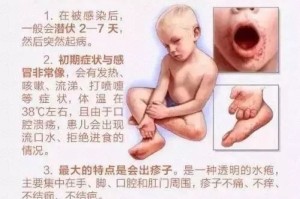 疫情的后遗症呕吐反胃（疫情期间呕吐怎么处理）