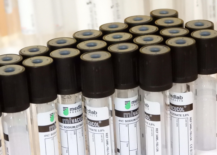 北京生物疫苗第二针间隔多久？科学接种，筑牢免疫屏障